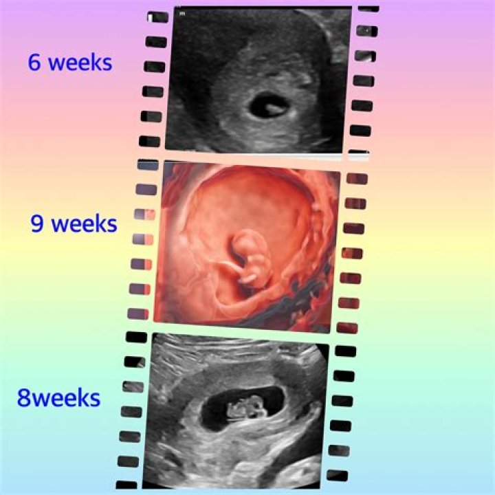 Alarming Miscarriage Photos at 6 Weeks: A Cautionary Tale