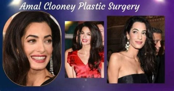 Amal Clooney Plastic Surgery: The Untold Truth Behind the Rumors