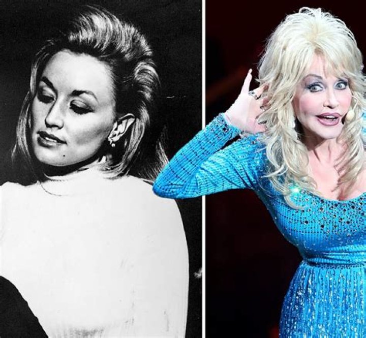 Dolly Parton: The Iconic Star Without Her Wig