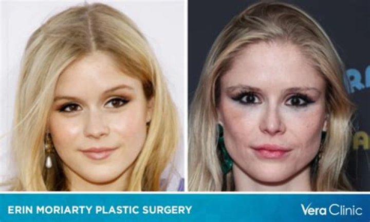 Erin Moriarty Before and After: A Comprehensive Look at Her Transformation