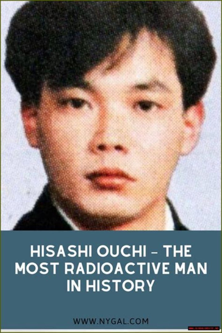 Hisashi Ouchi Real Photos: The Tragic Story Behind the Images