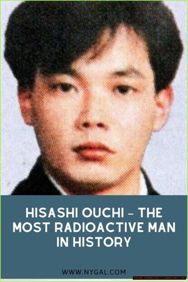 Hisashi Ouchi: The True Story Behind the Real Photos