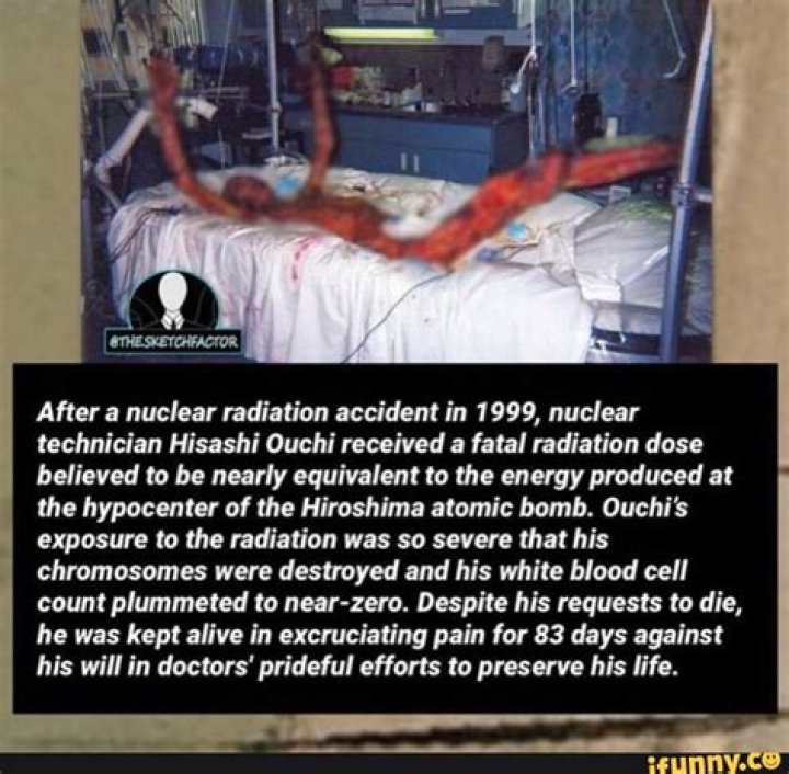 Hisashi Ouchi: The Untold Story of a Tragic Nuclear Accident Survivor