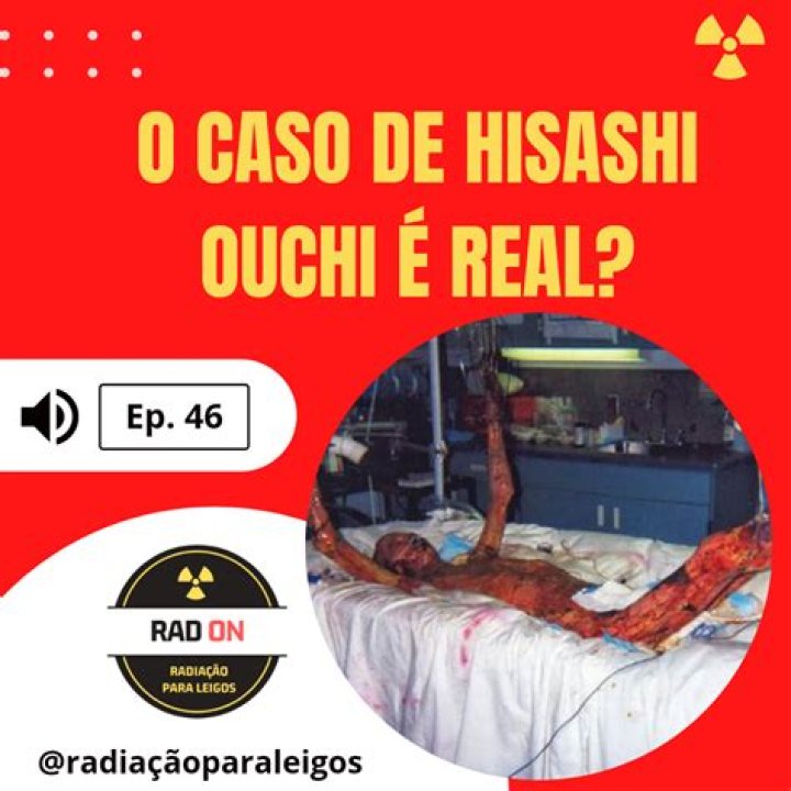 Hisashi Real Photos Day 85: An In-Depth Exploration