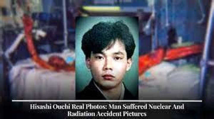 Hishashi Ouchi Real Photo: Unveiling the Truth Behind the Controversial Image