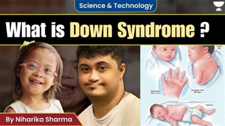 Hugh Grant and Down Syndrome: Exploring the Deeper Connection