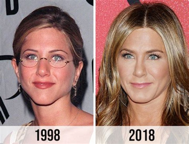 Jennifer Aniston Nose Job Before and After: The Truth Behind the Transformation