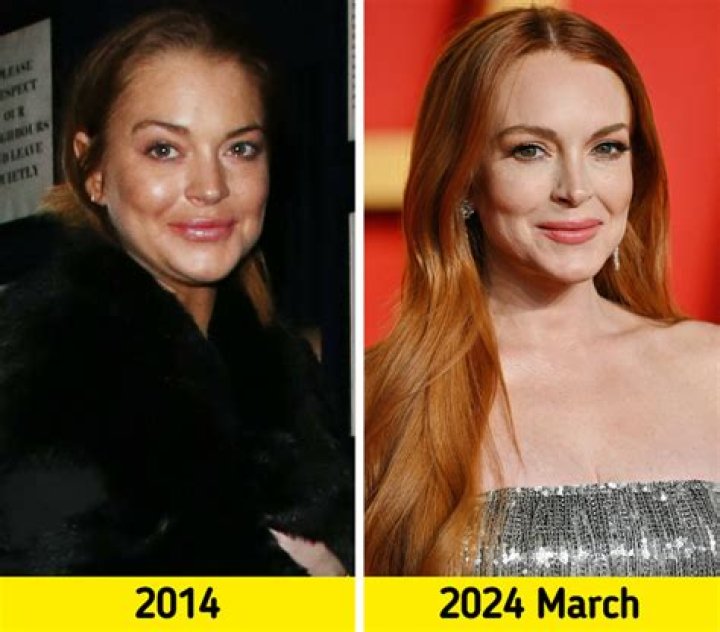 Kimberly Guilfoyle's Plastic Surgery Transformation: Unveiling the Truth