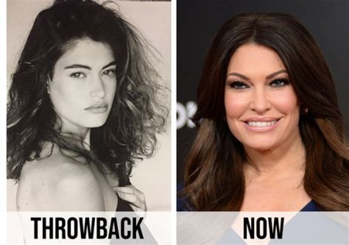 Kimberly Guilfoyle Before and After: A Comprehensive Look at Transformation