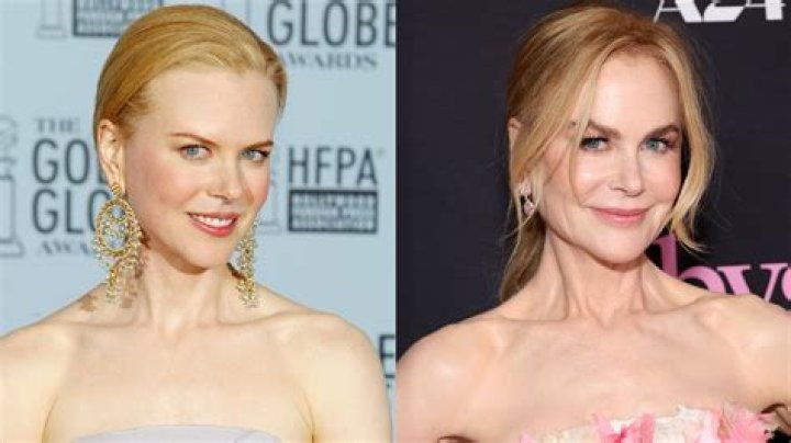 Nicole Kidman Plastic Surgery: A Comprehensive Analysis
