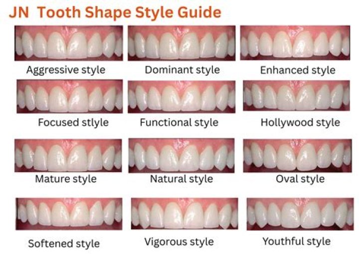 Overbite Celebrities: How This Dental Condition Shapes Smiles and Influences Confidence