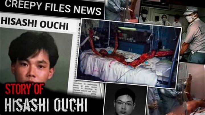 Real Hisashi Ouchi Photos: A Deep Dive into the Life and Legacy of a Tragic Incident