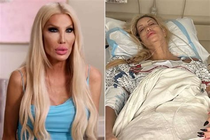 The Transformation of Nikki Exotika: A Look Back at Her Journey Before Surgery