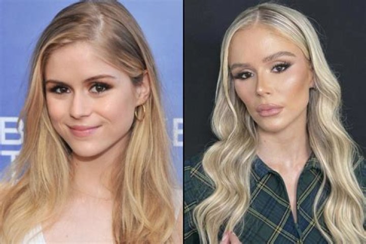 The Truth About Nina Dobrev's Plastic Surgery: Before and After Photos Revealed