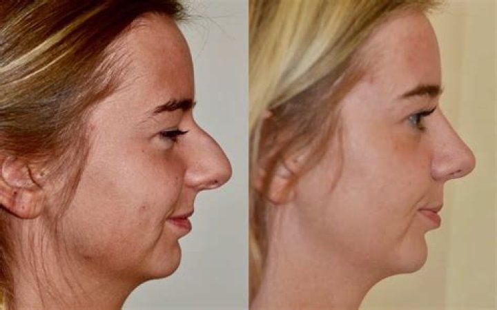 Trey Gowdy's Transformation: A Closer Look at His Face Surgery