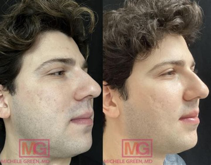 Trey Gowdy: A Look at His Nose Before and After