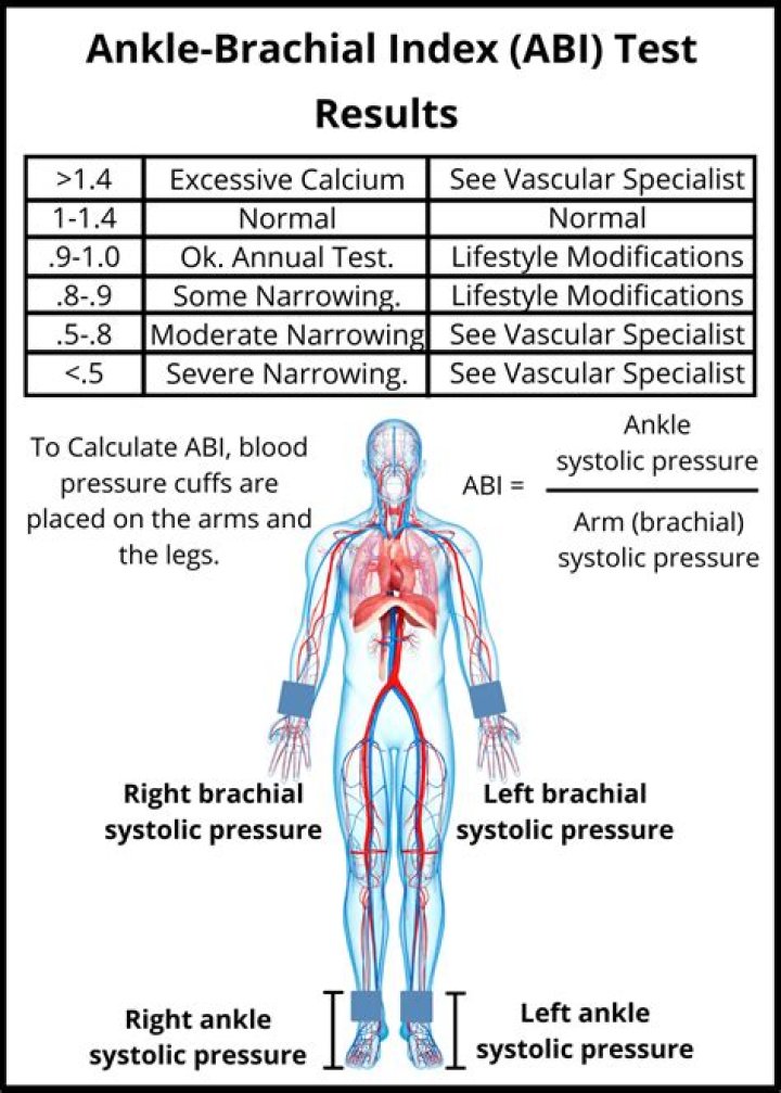 Understanding ABI Attachments: Your Comprehensive Guide