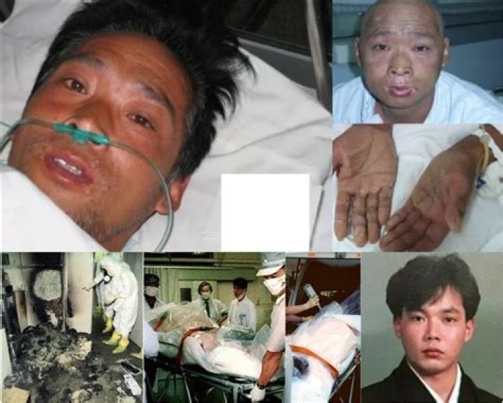 Understanding Hisashi Ouchi's Medical Images: A Deep Dive into a Tragic Case