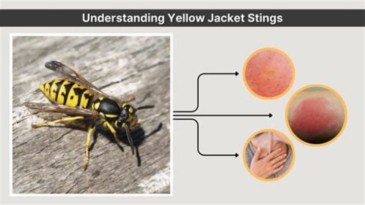 Understanding Pictures of Yellow Jacket Stings: An In-Depth Look
