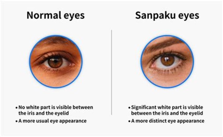 Understanding Sanpaku Eyes: The Cultural Significance and Psychological Insights