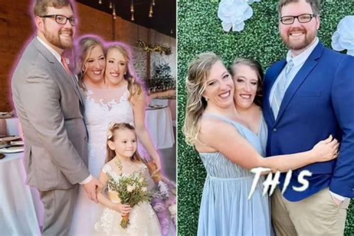 Understanding the Abby and Brittany Hensel Sad News: A Journey Through Their Lives