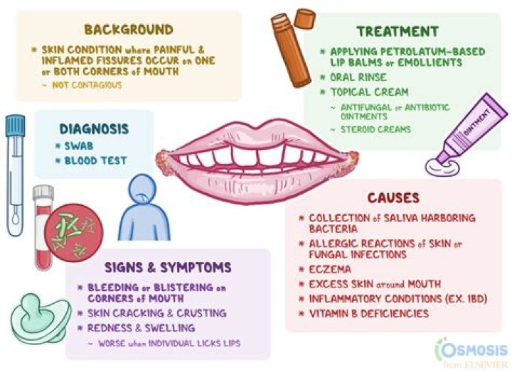 Understanding White Lips: Causes, Symptoms, and Treatment Options