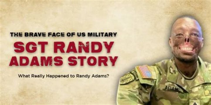 Unraveling the Mystery of Randy Adams' Face Accident