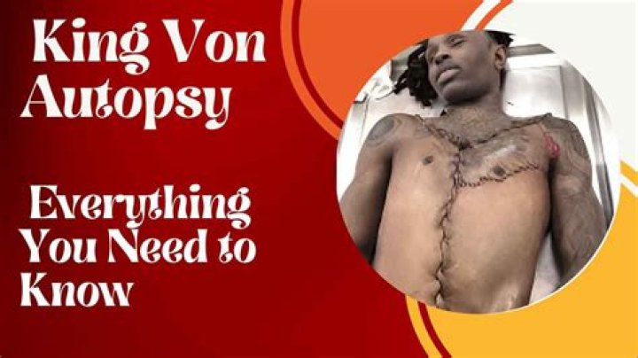 Unveiling the Mystery: King Von Autopsy Pic and the Legacy He Left Behind