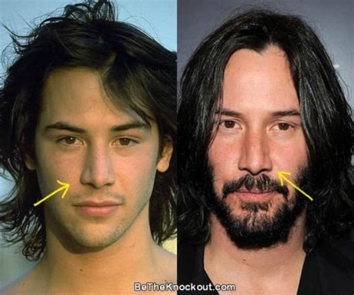 Unveiling the Truth Behind Keanu Reeves Plastic Surgery
