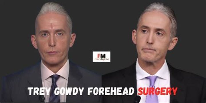 Unveiling the Truth: Has Trey Gowdy Had Plastic Surgery?