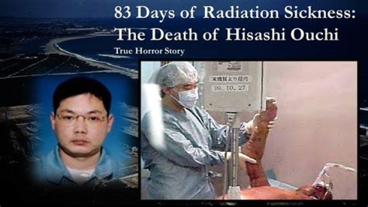 Unveiling the Truth: Hisashi Ouchi Real Photos Hospital