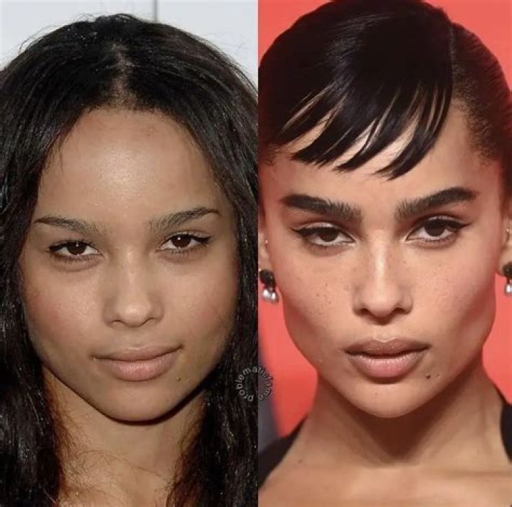 Zoe Saldana Plastic Surgery: The Truth Behind the Rumors